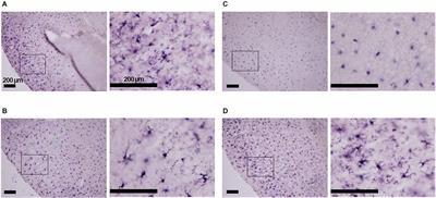 Minocycline prevents hypoxia-induced seizures